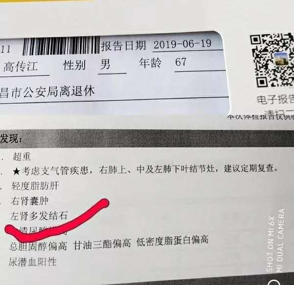 治疗仪招商 治疗仪招商